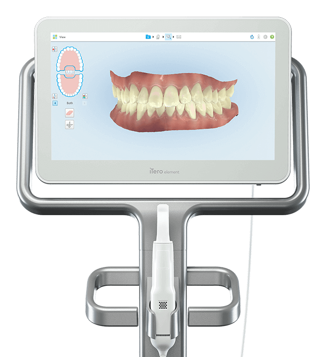 best invisalign provider in bangalore